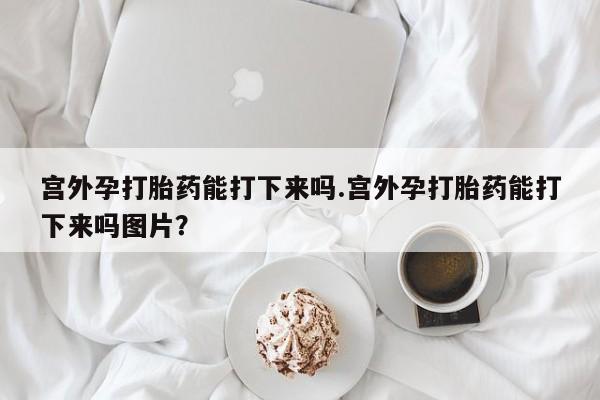 哪里有打胎药购买宫外孕打胎药能打下来吗.宫外孕打胎药能打下来吗图片？